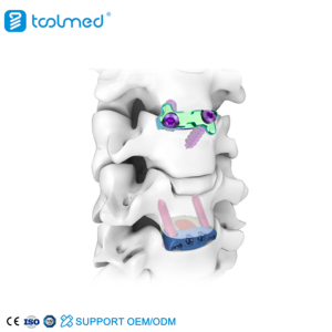 Medical Spine Fixation System Lumbar Cage Peek Cage Double Locking Screw Cervical Cone fusion Cagefor Surgery Spinal Implants