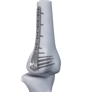 Proximal Humerus Femur Tibial Lock LCP Plate