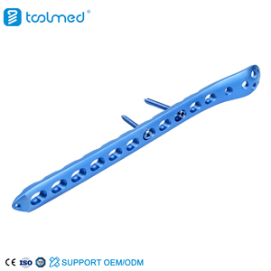 Orthopedic Implant Proximal Femoral Plate