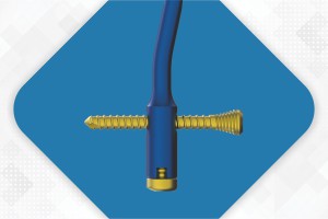 ELEGANT Radius Nail