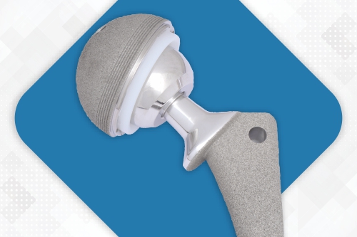 Revision Hip Replacement System - Modular Stems and Augments