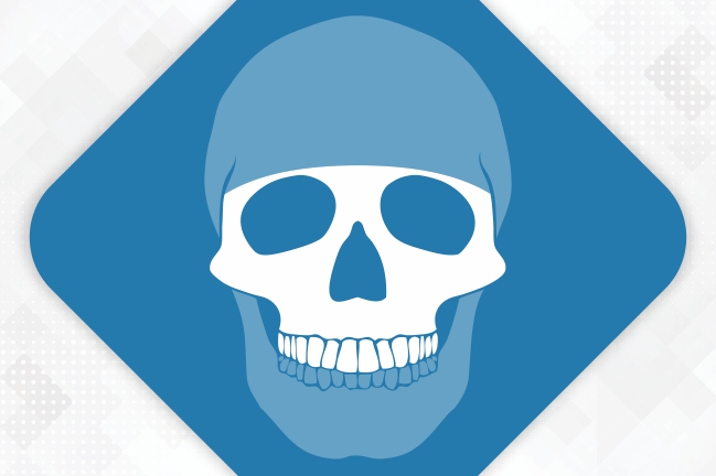 Midface Implants