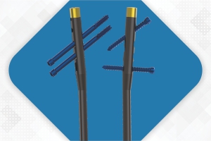 ELEGANT New Antegrade Femur Nail
