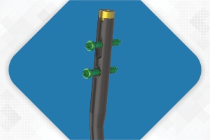 ELEGANT Universal Tibia Nail