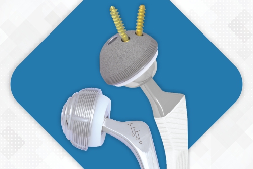 Primary Total Hip Replacement System - Femoral Stem and Acetabular Cup