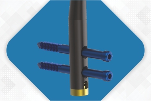 ELEGANT Supracondylar Femoral Nail