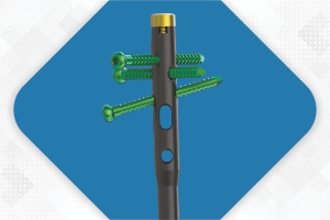 ELEGANT Multiple Locking Tibia Nail