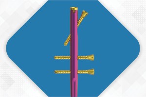 ELEGANT Ulna Nail