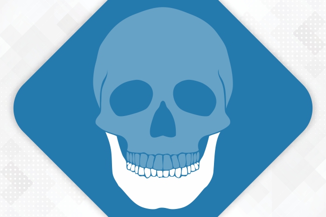 Mandible Implants
